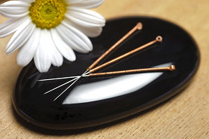 History of Acupuncture